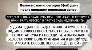 Антон Гусев: Сегодня была адская ночь